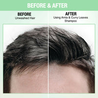 Thumbnail for Nykaa Naturals Longer & Thicker Hair - Free Shampoo With Amla, Curry Leaves & Coconut Oil - Distacart