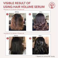 Thumbnail for Ivory Natural Hair Volume Serum For Hair Thinning And Healthier Growth - Distacart