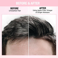 Thumbnail for Nykaa Naturals Anti-Dandruff - Free Shampoo with Apple Cider Vinegar, Ginger & Tea Tree Oil - Distacart