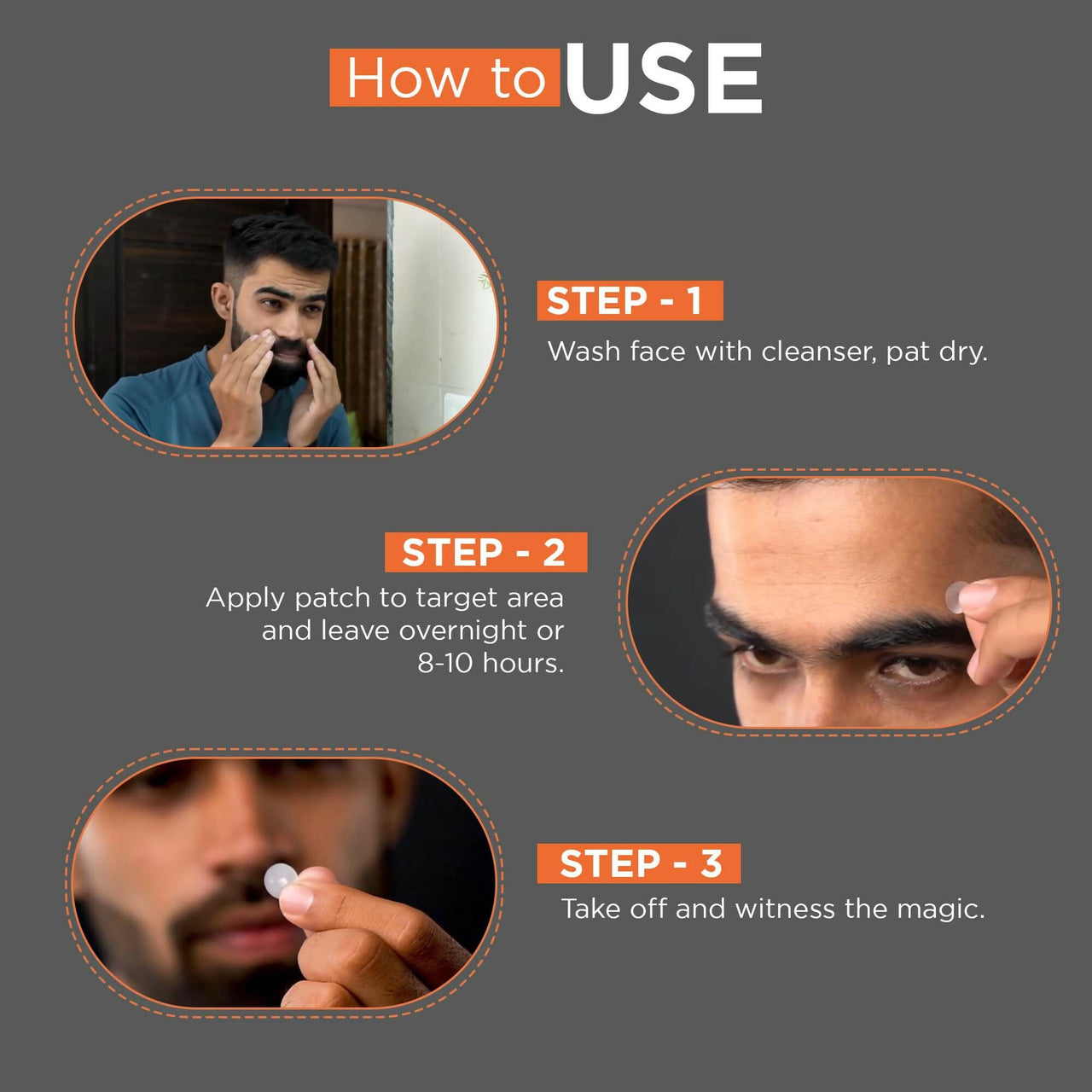 Beardhood Acne Pimple Patch Hydrocolloid Waterproof Patches For Active Surface Acne, Absorbs Pimple Overnight