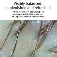 Thumbnail for Aveda Scalp Solutions Overnight Scalp Renewal Hair Serum - Distacart