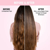 Thumbnail for Nykaa Naturals Anti-Dandruff Shampoo - Distacart