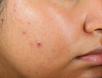 Thumbnail for Murad Clarifying Water Gel