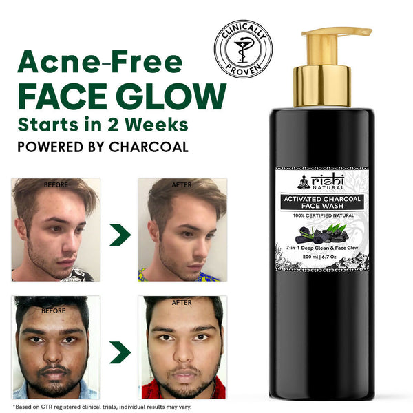 Copy of ACTIVATED CHARCOAL FACE WASH BEFORE AFTER