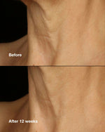 Thumbnail for Clinique Smart Clinical Repair Lifting Face & Neck Cream - Distacart