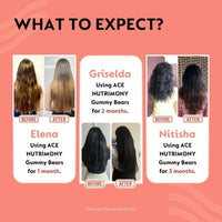 Thumbnail for Ace Nutrimony Biotin Balanced Beauty Hair Gummies for Skin and Nails with Clinically Proven Keranat, Biotin - Strawberry - Distacart
