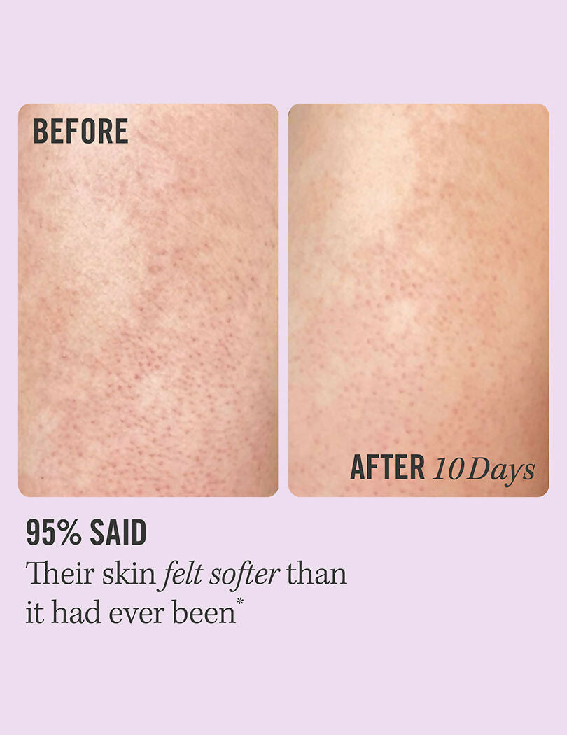 3429d2fFIRAD00000021_2