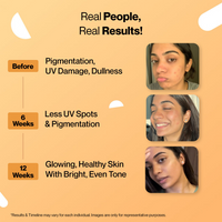 Thumbnail for Setu Skin Renew Glutathione With Vitamin C Effervescent Tablets - Orange Flavor