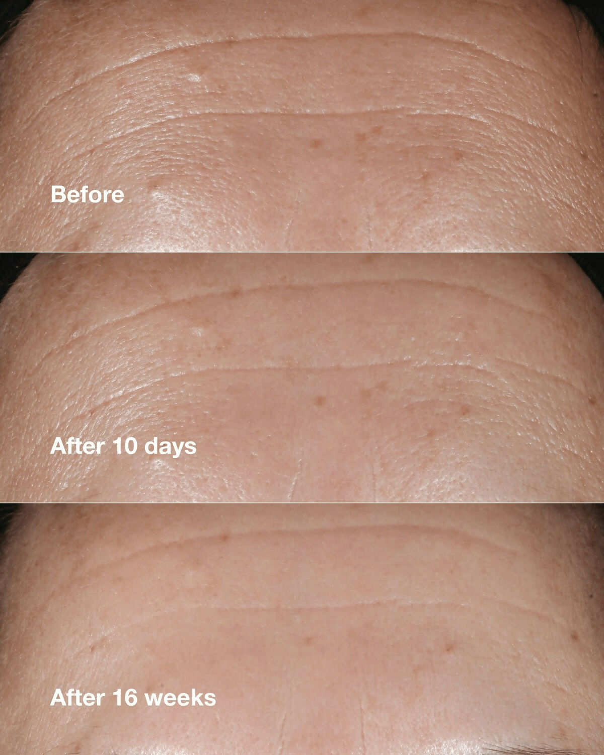 Clinique Smart Clinical Repair Wrinkle Correcting Serum - Distacart
