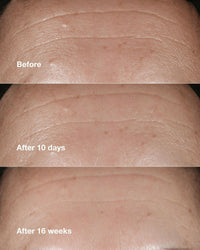 Thumbnail for Clinique Smart Clinical Repair Wrinkle Correcting Serum - Distacart