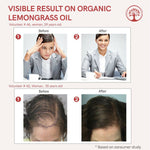 Thumbnail for Ivory Natural Organic Lemongrass Oil Pure & Premium Essential Oil For Face, Scalp & Skin - Distacart