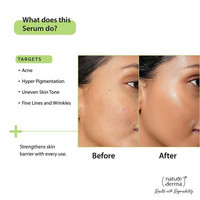 Thumbnail for Nature Derma 2% Salicylic Acid Serum - Distacart