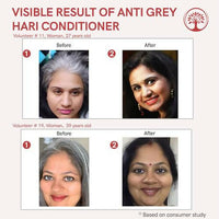 Thumbnail for Ivory Natural Grey Hair Conditioner For Early Of Greying, Strengthens Hair - Distacart