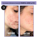 Thumbnail for Sereko Niacinamide & Vitamin C Face Toner Spray Mist for Glowing & Brightening Skin - Distacart