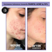 Thumbnail for Sereko Niacinamide & Vitamin C Face Toner Spray Mist for Glowing & Brightening Skin