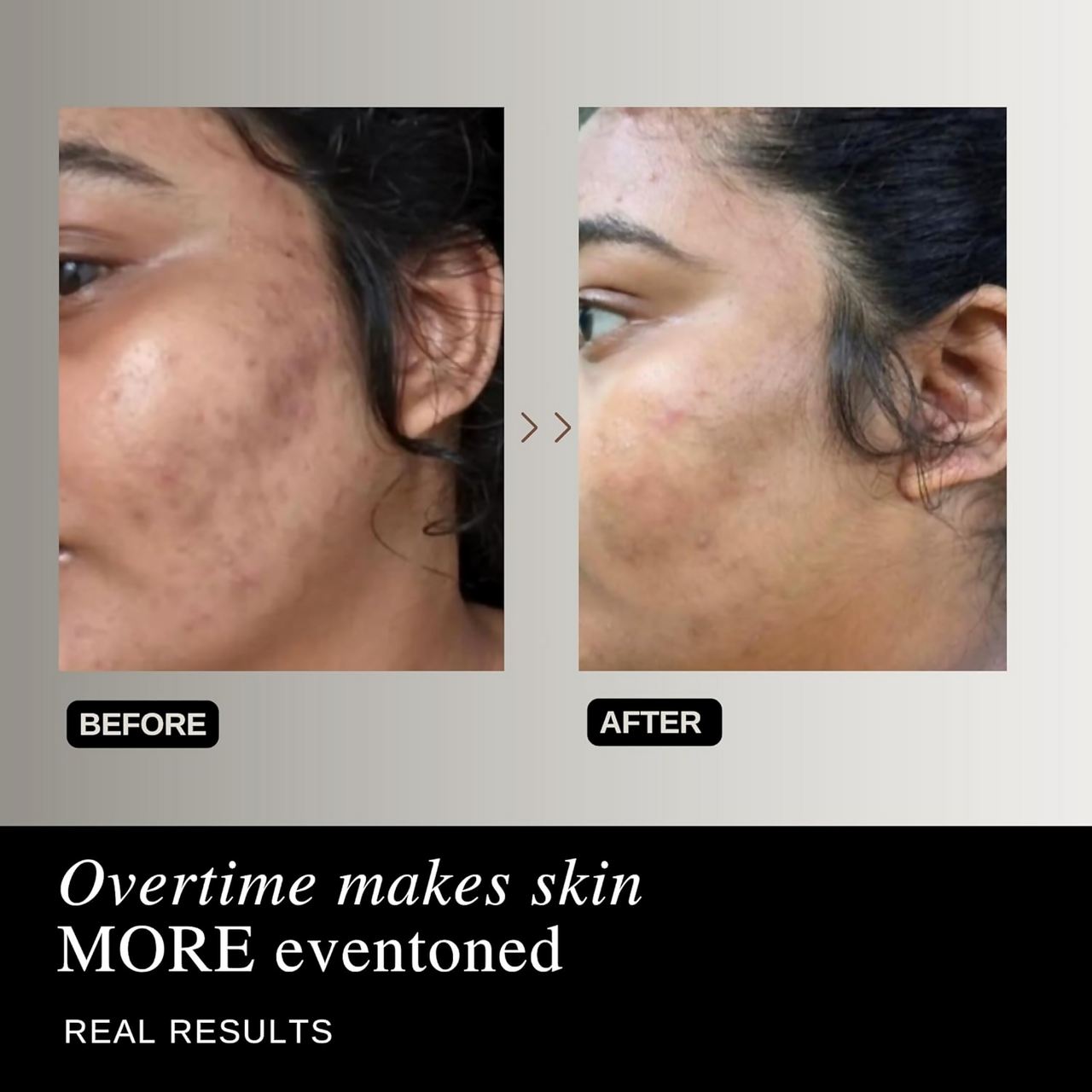 The Formularx Air Brush Facial All In One Lactic Acid Serum For Instant Radiance