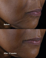 Thumbnail for Clinique Smart Clinical Repair Lifting Face & Neck Cream - Distacart