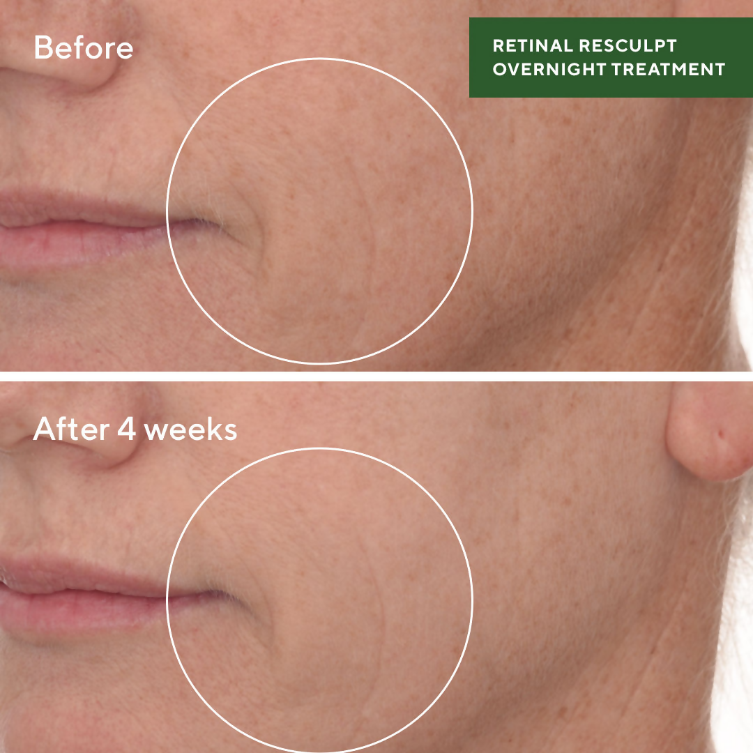 Murad Retinal ReSculpt Overnight Treatment - Distacart