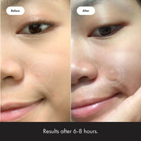 Thumbnail for Mighty Patch Mighty Hero Cosmetics Patches Hydrocolloid Acne Absorbing Spot Dot