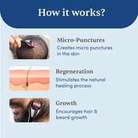 Thumbnail for Man Matters Derma Roller with 540 Titanium Alloy Micro Needles 0.5 mm