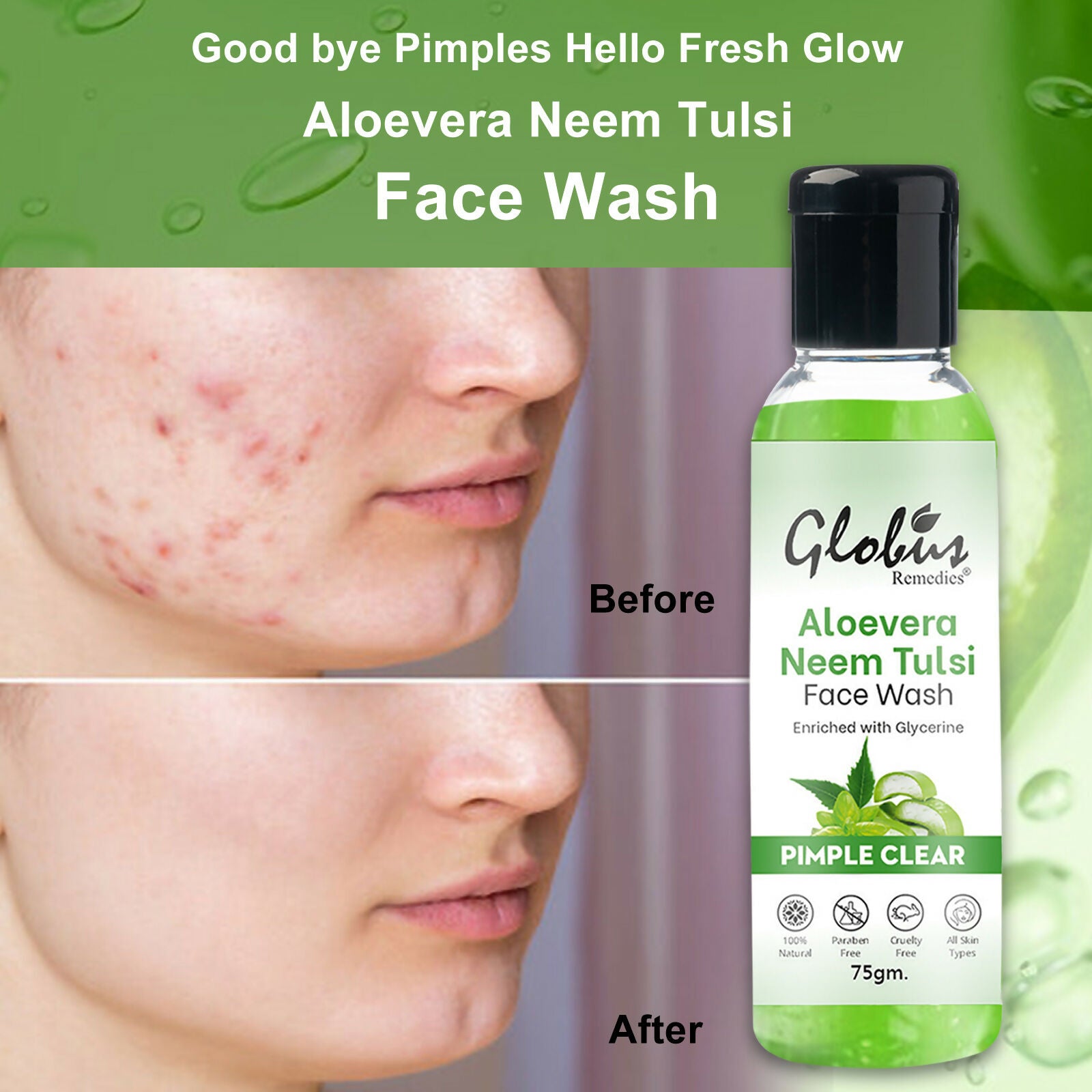 Globus Remedies Aloe vera Neem Tulsi Enriched With Glycerin & Oil Control Formula