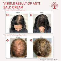 Thumbnail for Ivory Natural Bald Cream For Hair For Stimulate Growth Of Hair, Avoid Thinning - Distacart