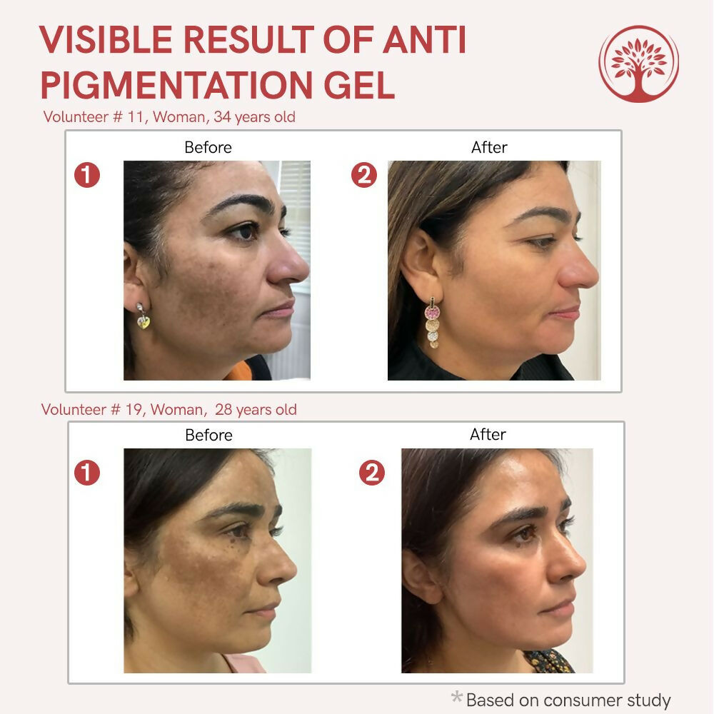 Ivory Natural Pigmentation Gel For Fade Dark Spots & Pigmentation - Distacart