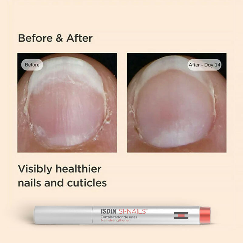 c0e2f2d8470001915528ab_5