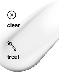 Thumbnail for Clinique Anti-Blemish Solutions All-Over Clearing Gel - Distacart