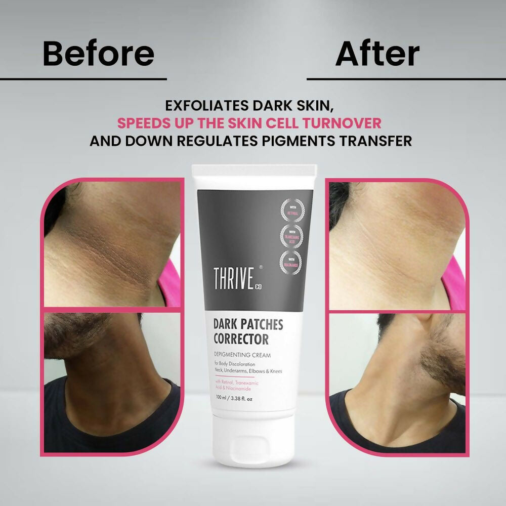 Thriveco Dark Patches Corrector Cream - Distacart