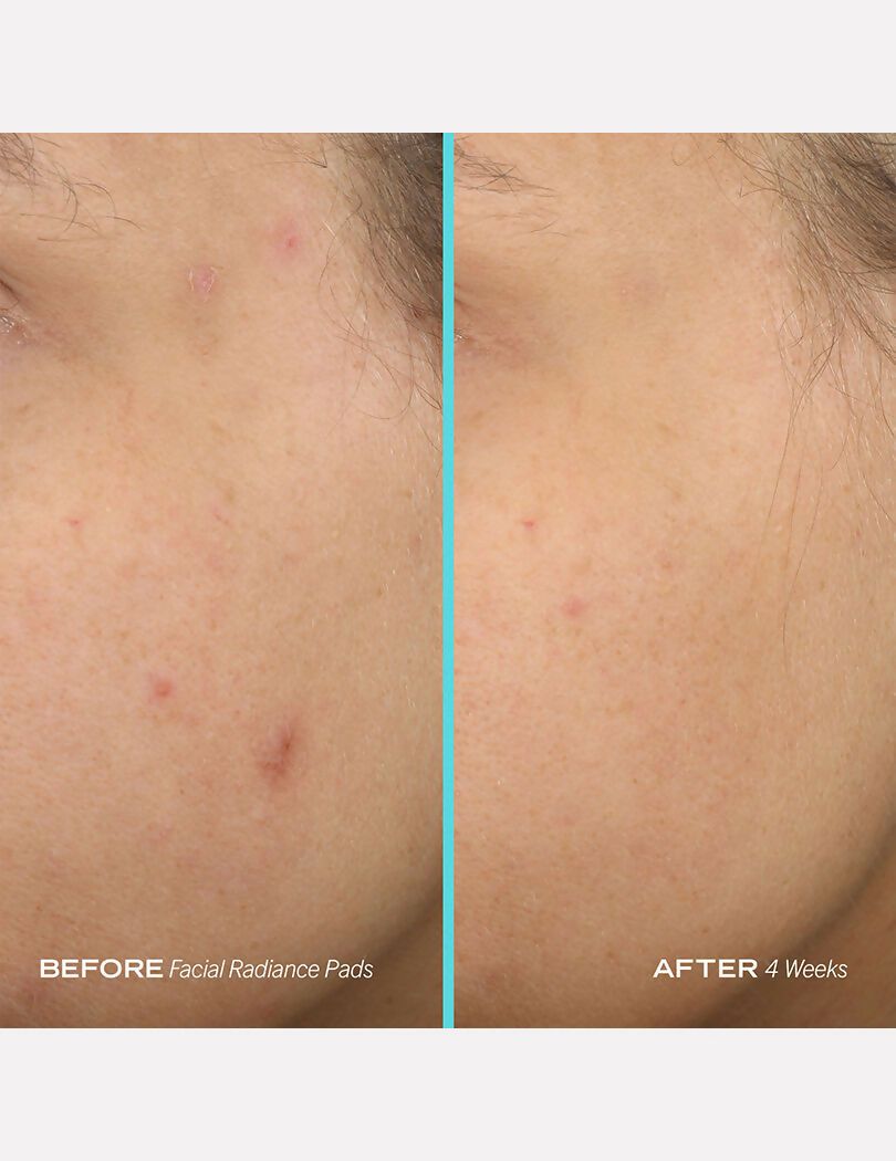 3429d2fFIRAD00000006_3