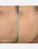 Thumbnail for 3429d2fFIRAD00000006_3