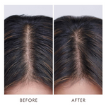 Thumbnail for Moroccanoil Oily Scalp Treatment For Oily, Imbalanced Scalps - Distacart