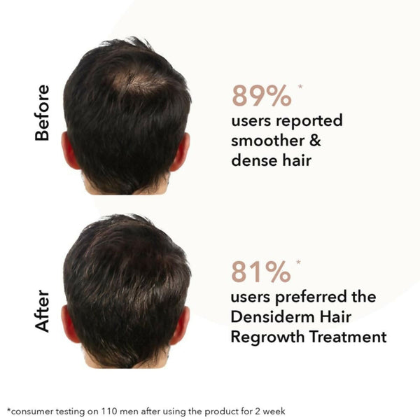 Professional O3+ Men Densiderm Anti Hair Loss Shampoo For Dense Hair & Regrowth - Distacart