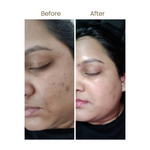 Thumbnail for Personal Touch Mucin Serum With Hyaluronic Acids, Ceramides & Niacinamide - Distacart