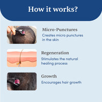 Thumbnail for Man Matters Derma Roller 1.00 mm With 540 Titanium Alloy Needles - Promotes Beard Growth & Reduces Acne Scars