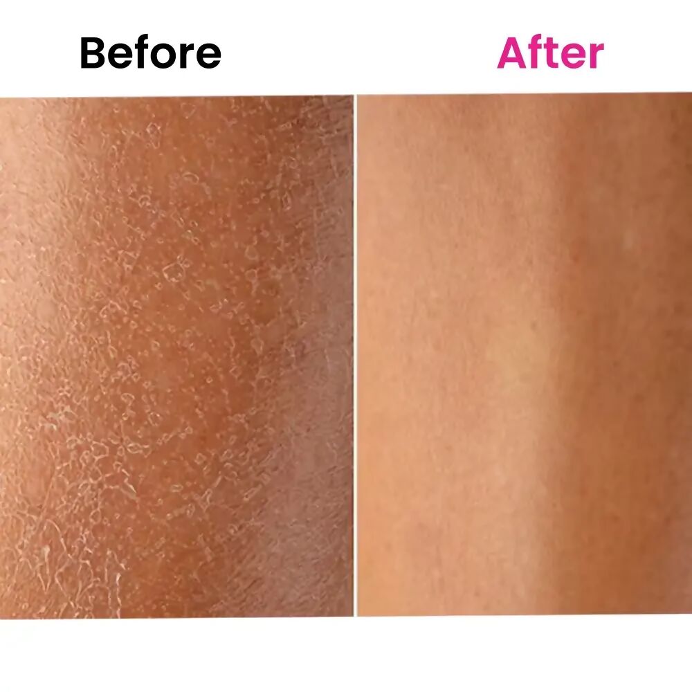 ThriveCo Skin Expert Oil - Distacart