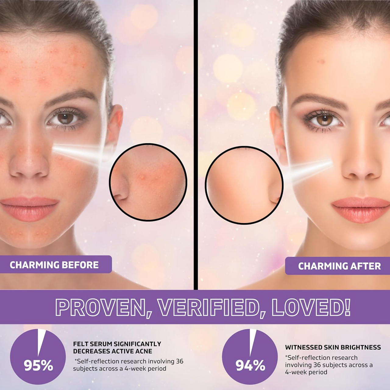 Kisra Anti-Acne Face Serum for Acne