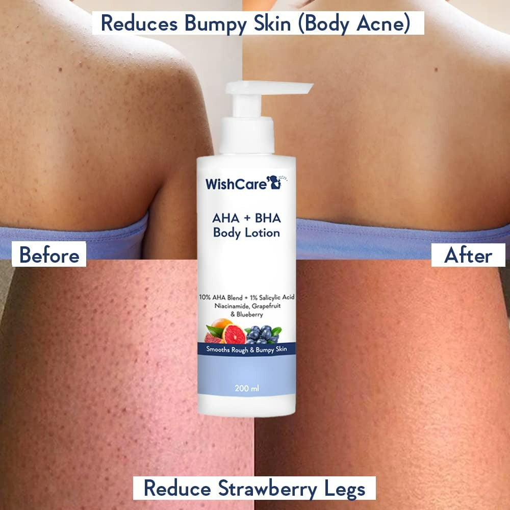 WishCare 10% AHA + 1% BHA Body Lotion for Smooths Rough & Bumpy Skin - Distacart