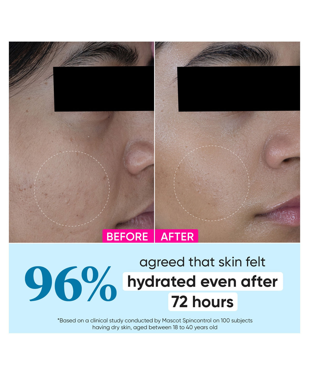 Dot & Key 72 Hr Hydrating Probiotic Face Gel With With Hyaluronic Acid, Kombucha & Rice Water - Distacart