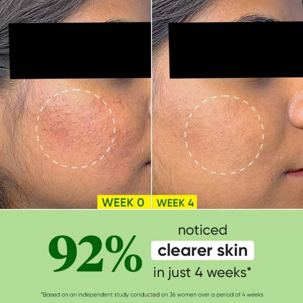 Dot & Key CICA +Niacinamide Oil Free Moisturizer - Distacart