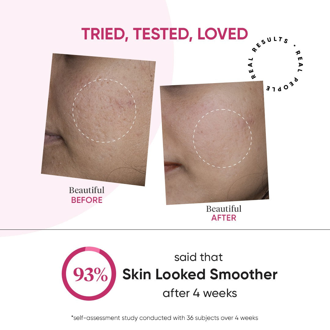 Dot & Key Collagen Restorative Time Reverse Retinol Serum - Distacart
