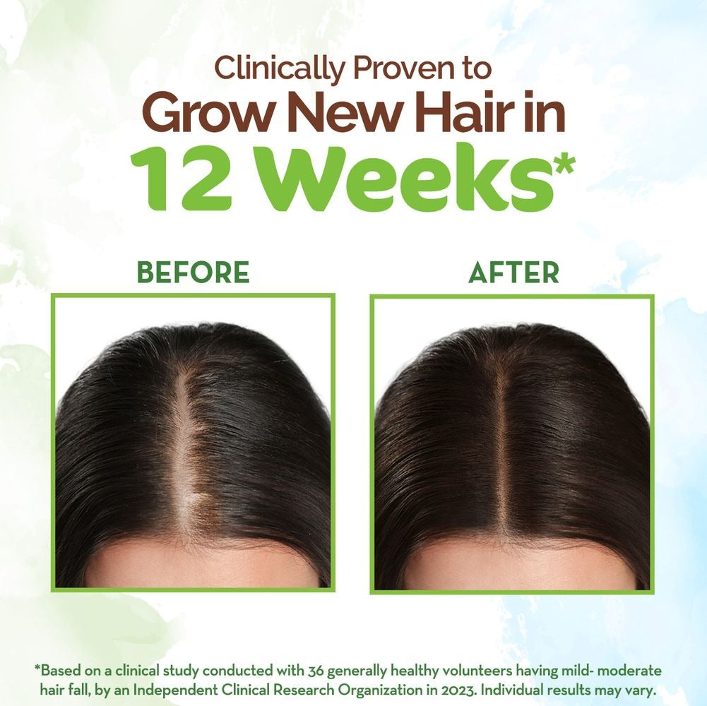 Mamaearth Rosemary Hair Growth Oil with Rosemary & Methi Dana - Distacart