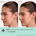 Thumbnail for Lotus DermaBotanics Kojic Acid + Multi Berry Ampoule Crème, pH5.5, For Sensitive Skin additional image 4