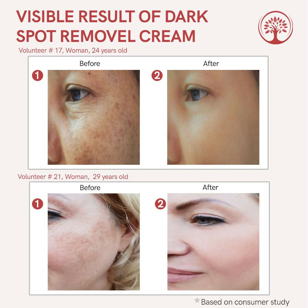 Ivory Natural Dark Spot Removal Face Cream For Dark Spots And Achieve A Glowing Tone - Distacart