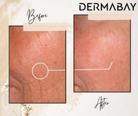 Thumbnail for Dermabay Retinol 0.2% Face Serum