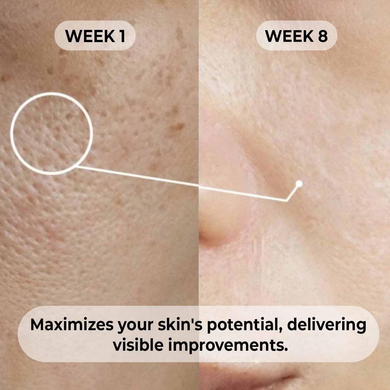 Dermabay Niacinamide 5%+ Hyaluronic acid 1% Serum