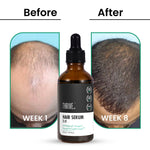 Thumbnail for ThriveCo Hair Growth Serum 2.0 - Distacart