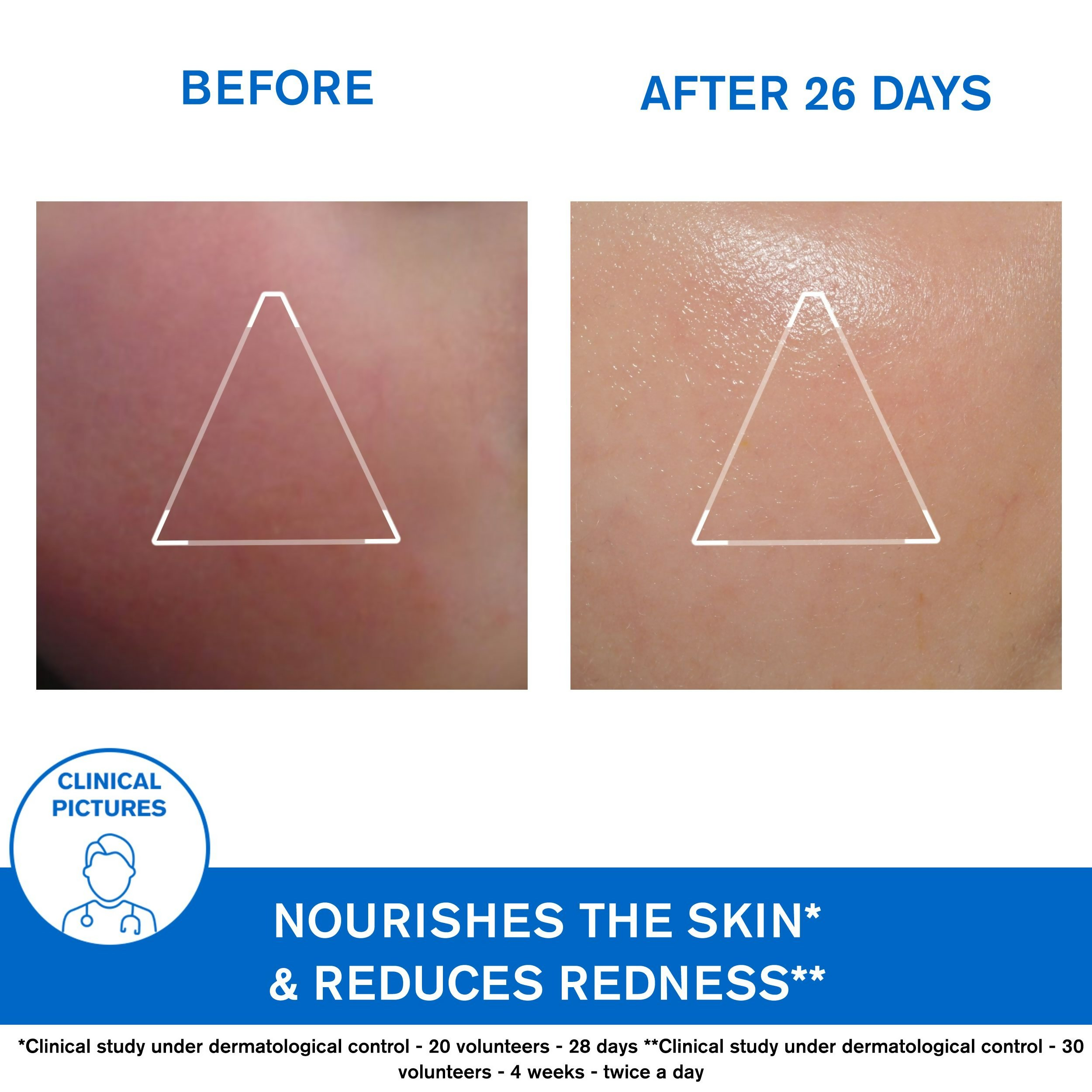 Uriage Xemose Face Cream - Distacart