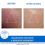 Thumbnail for Uriage Xemose Face Cream - Distacart